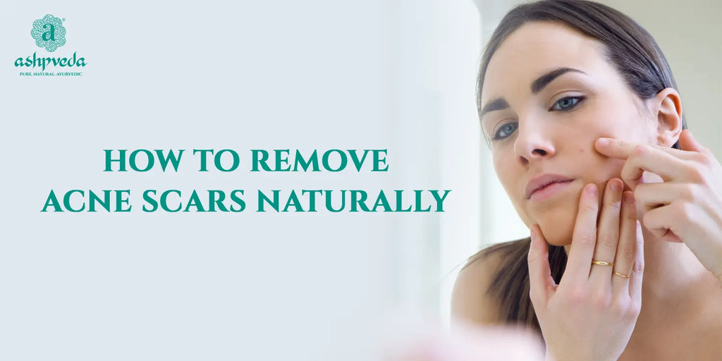 How To Remove Acne Scars Naturally: Guide To Clearer Skin