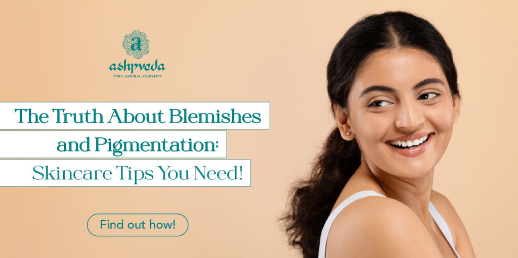 Blemishes And Pigmentation: What’s The Difference & How To Treat It